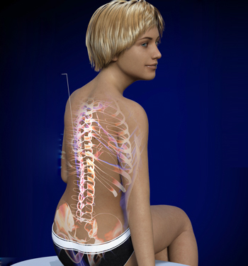 Latissimus Dorsi